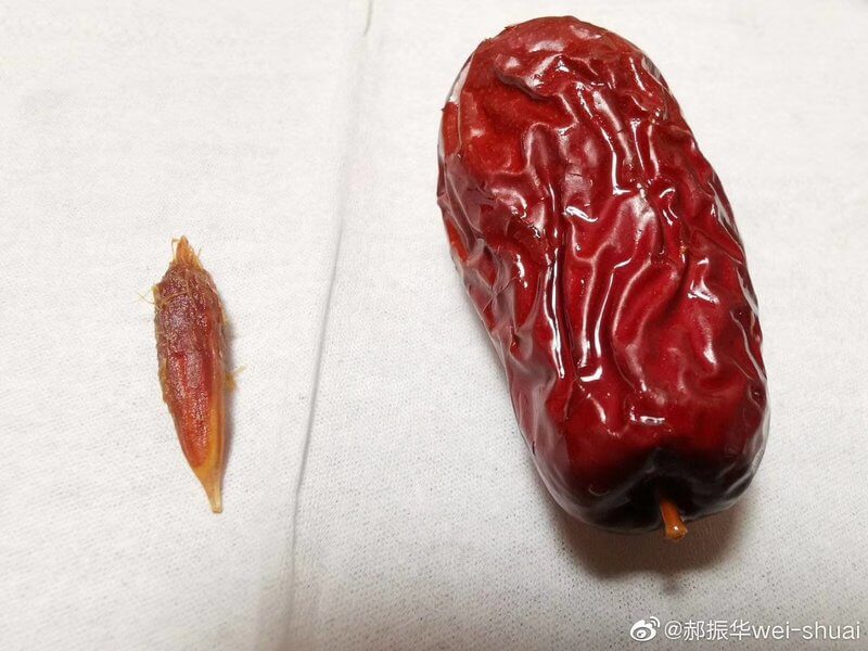 һ�w�����U(xi��n)Щ���l(f��)��Ѫ��